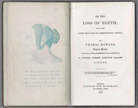 HOWARD, Thomas. - On the Loss of the Teeth; and on the best means of restoring them.